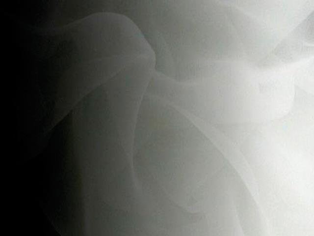 Shading On Satin Chiffon BLACK/WHITE